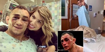 توني فيرغسون يخسر من غيتشي ويفوز ب 500 ألف دولار
