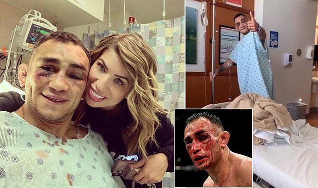 توني فيرغسون يخسر من غيتشي ويفوز ب 500 ألف دولار