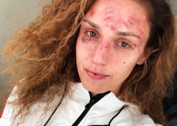 شيفتشينكو تكشف عن وجهها بعد تلقيها 45 ضربة (فيديو)