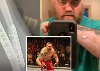 بعد رفض UFC معالجته.. مقاتل أمريكي يلجأ لمتابعيه من أجل مساعدته