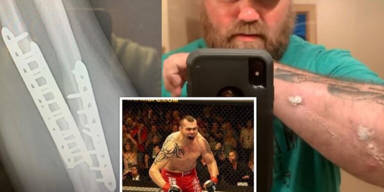 بعد رفض UFC معالجته.. مقاتل أمريكي يلجأ لمتابعيه من أجل مساعدته