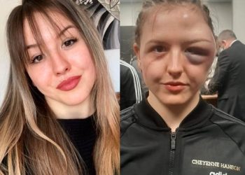 الملاكمة حولت وجه اللاعبة الحسناء إلى شكل مريع