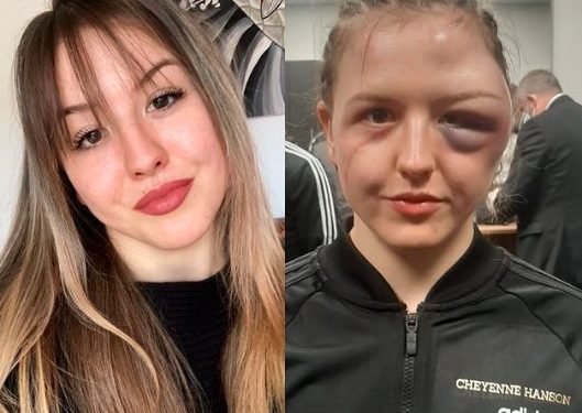 الملاكمة حولت وجه اللاعبة الحسناء إلى شكل مريع